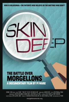 ბრძოლა მორჯელონზე ქართულად - Skin Deep: The
