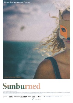 მზით დამწვარი ქართულად - Sunburned