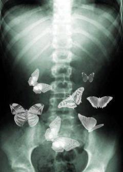 THE BUTTERFLY EFFECT
